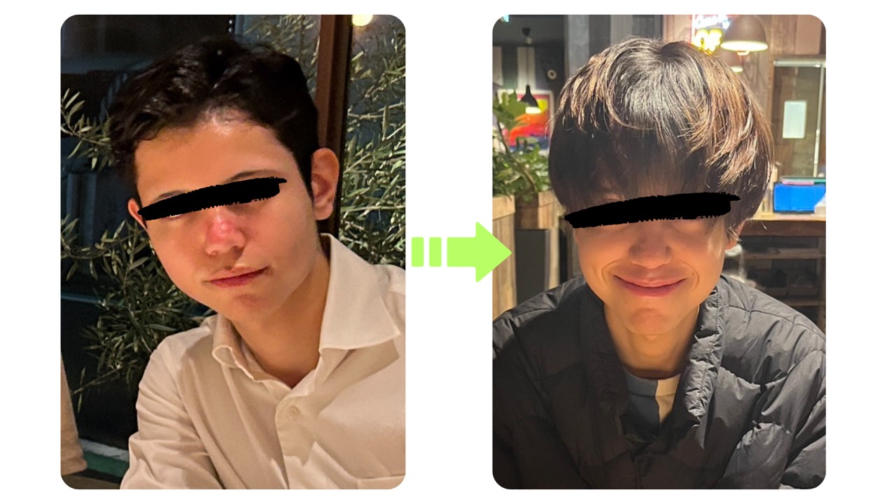 ビフォーアフターの写真例1